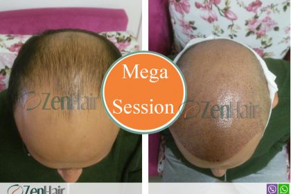 mega seesion