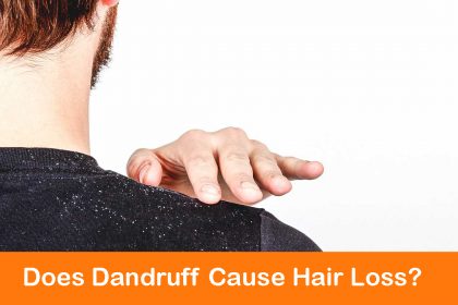 1296x728_Is_Dandruff_Contagious_HEADER