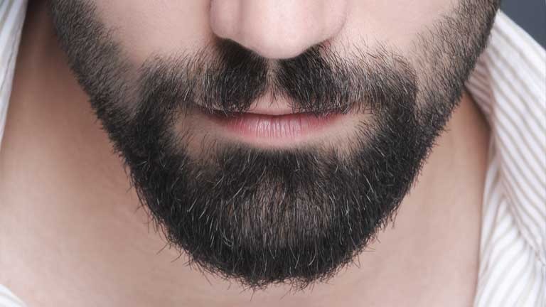 Moustache & Beard Transplant
